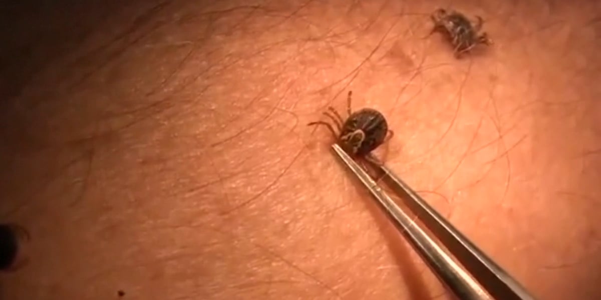 Ticks Digging In ON YOUR SIDE: Spring tick dangers; ways to keep your family and pets safe