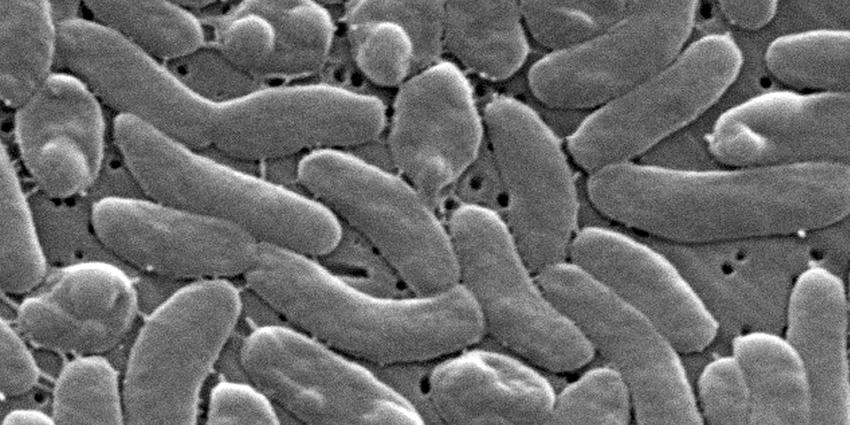 Photo: KY3 Louisiana Reports 5 Deaths From Vibrio Vulnificus Flesh-Eating Bacteria